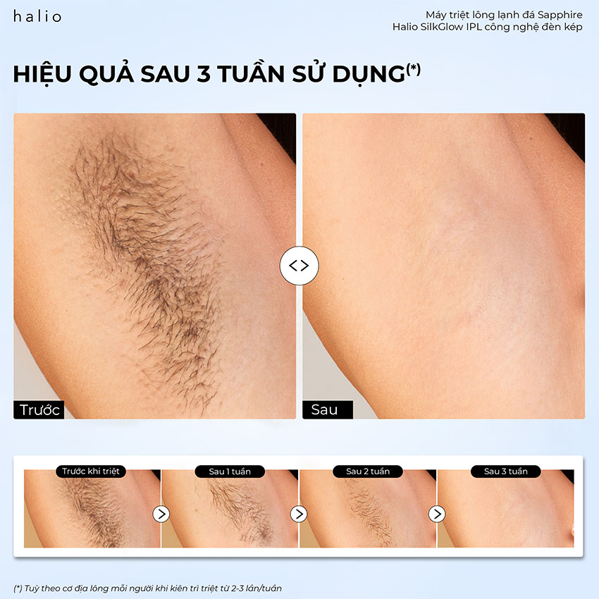 Máy Triệt Lông Lạnh Halio SilkGlow IPL Sapphire Cooling Hair Removal Device 8